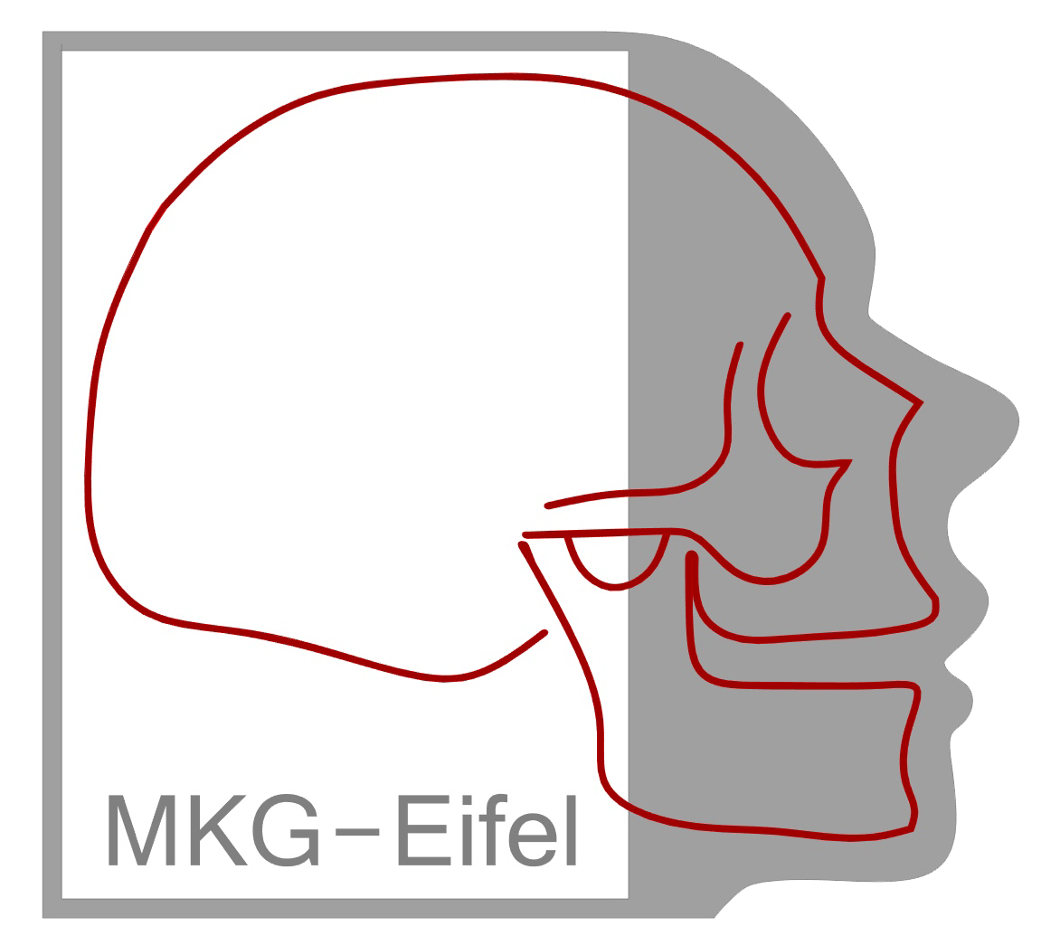 MKG-Eifel
